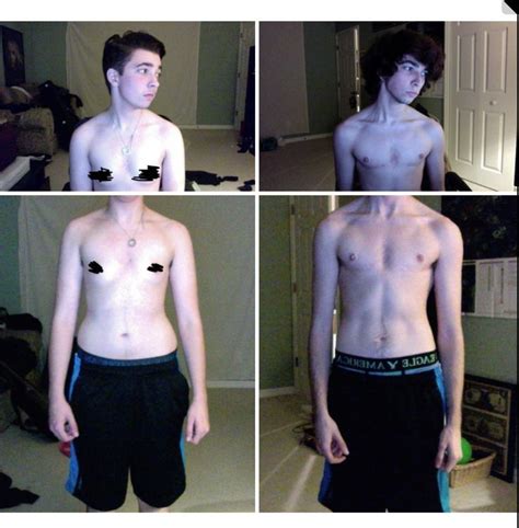 The first time I saw my chest I fought back. . Bottom surgery ftm results reddit